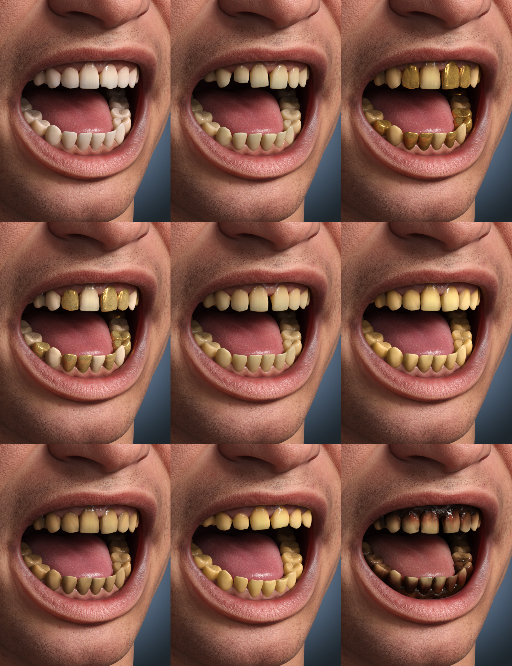 图片[1]-[daz角色] Genesis 9的牙齿要素形状和材料-DAZ爱好者